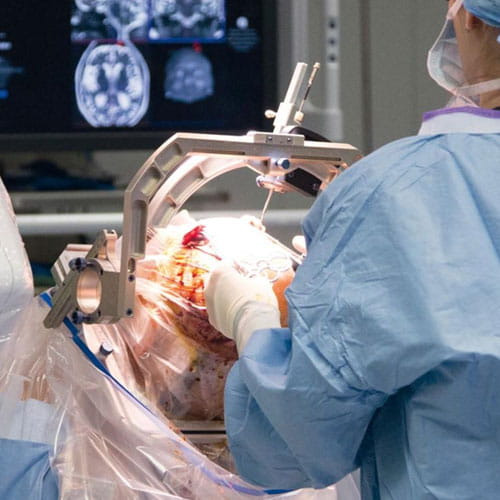 Neurosurgery